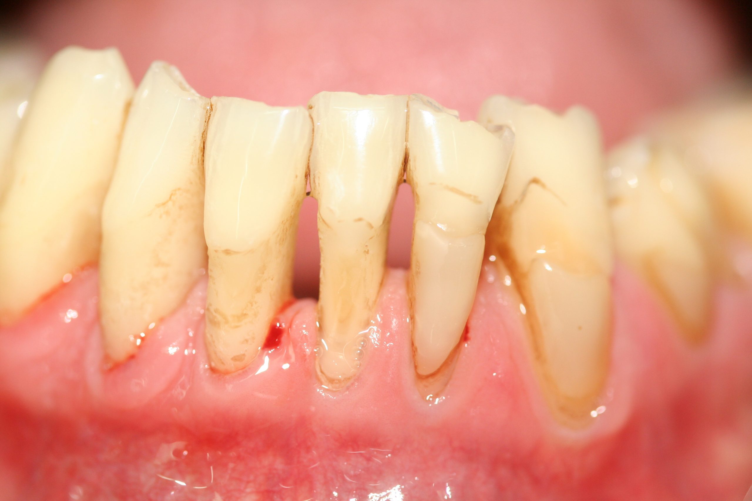 PERIODONCIA-scaled