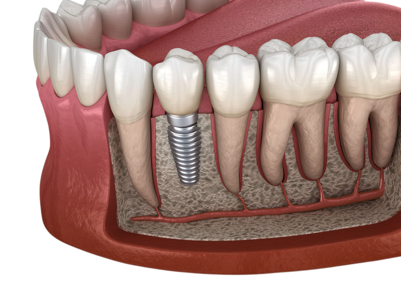 129555779_s-Photoroom