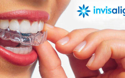 Invisalign