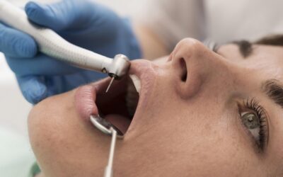 Limpiezas bucales periódicas: la clave para una sonrisa sana